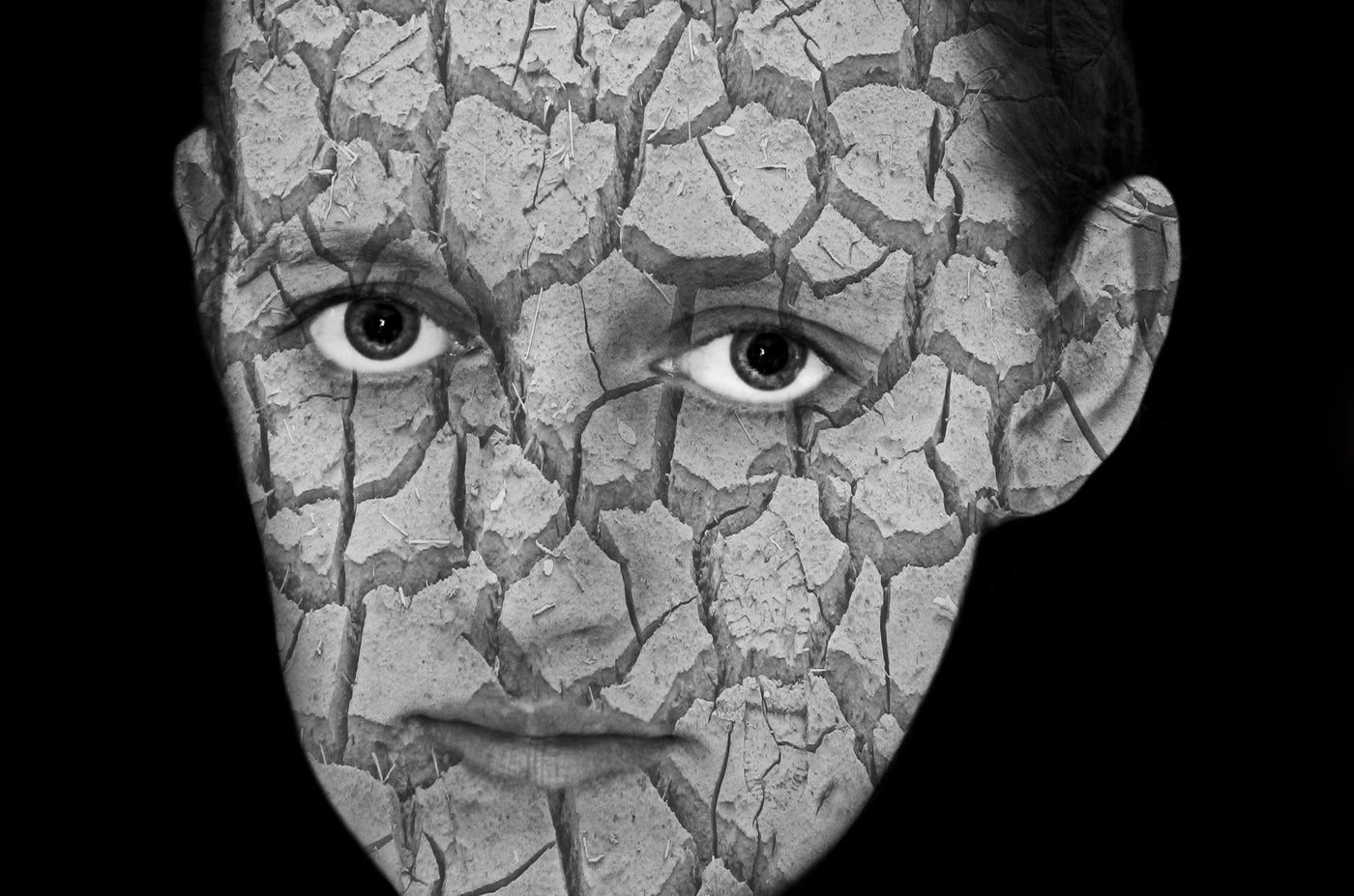 Dehydrated Skin Symptoms and How to Fix It